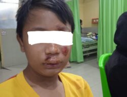 Oknum Debt collector Kembali Berulah, Orang tua Korban: Tape Anak So Ancor Bagini Sampe Maso Rumah Sakit, Ta Balas Pa Ngoni !